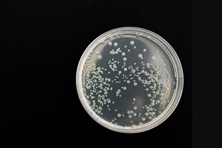 Cómo crear un cultivo de bacterias en casa